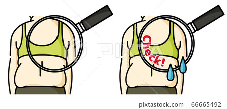 Obese woman back-close up Obese woman back-close up 66665492