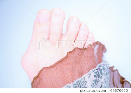Hallux valgus bare feet Hallux valgus bare feet 66670020