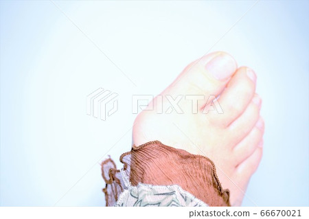 拇外翻裸腳 66670021