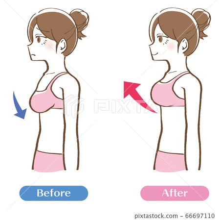 Bust-up before-after illustration Bust-up before-after illustration 66697110