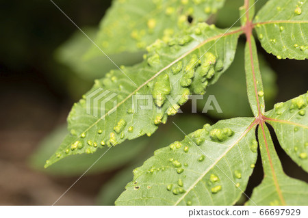 癭瘤 癭瘤 66697929