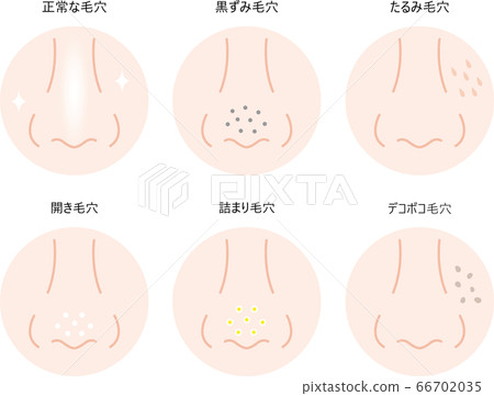 鼻孔定型 66702035
