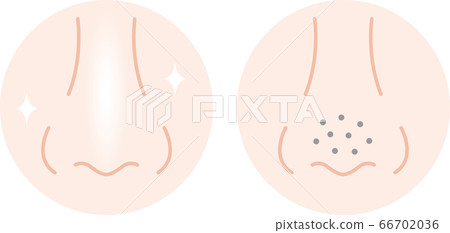 Pores on nose before after 66702036