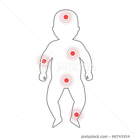 Pain in human body 66743954