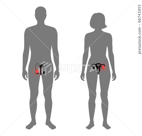 Pain in human body 66743955