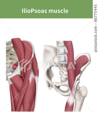 髖關節醫學插圖 66775445