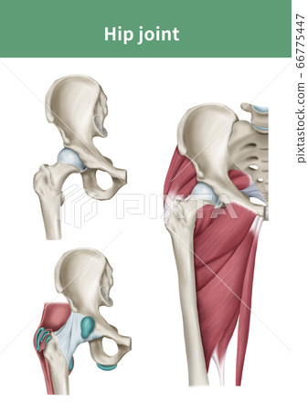 髖關節醫學插圖 66775447
