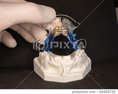 Tooth retainer for orthodontic correction of jaw Tooth retainer for orthodontic correction of jaw 66808718