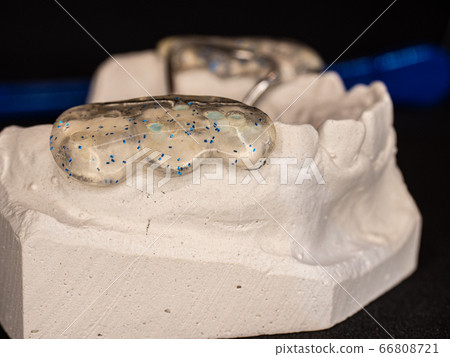 Jaw with orthodontic expand retainer Jaw with orthodontic expand retainer 66808721