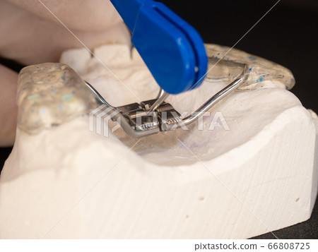 Patients upper palate with congenital defects 66808725