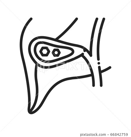 Pancreatic stones black line icon. Acute pancreatitis. Human organ concept. Sign for web page, mobile app, button, logo. Vector isolated element. Editable stroke 66842759
