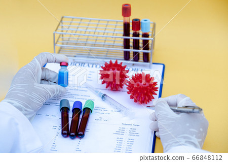 Lab personnel hand recording the blood test results Lab personnel hand recording the blood test results 66848112