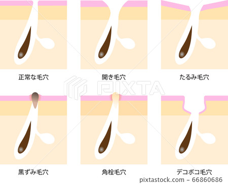 Pores skin cross section set Pores skin cross section set 66860686