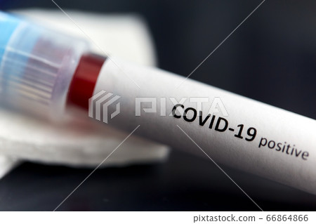 beaker with coronavirus blood test at laboratory beaker with coronavirus blood test at laboratory 66864866