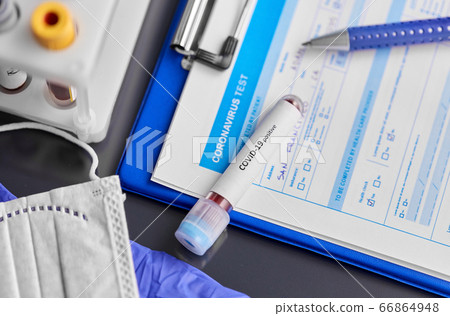 beaker with coronavirus blood test at hospital beaker with coronavirus blood test at hospital 66864948