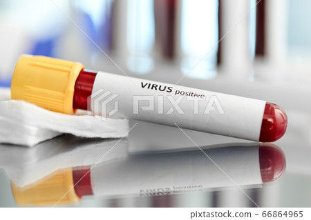 beaker with virus blood test at laboratory 66864965