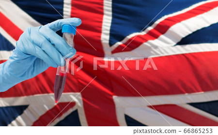 hand holding test tube with coronavirus blood test 66865253