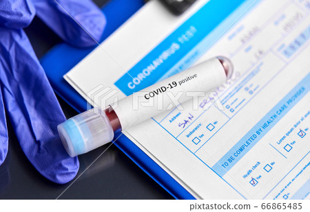close up of beaker with coronavirus blood test 66865485