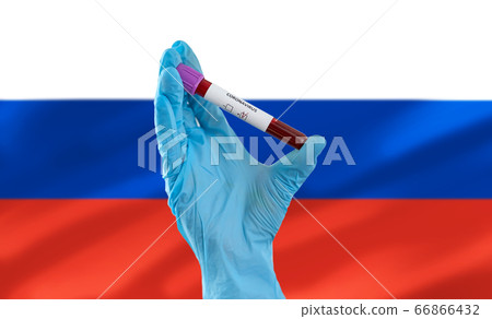 hand holding beaker with coronavirus blood test hand holding beaker with coronavirus blood test 66866432