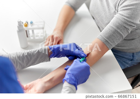 doctor taking blood for test from patient's hand 66867151