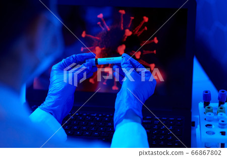 hand holding beaker with coronavirus blood test hand holding beaker with coronavirus blood test 66867802