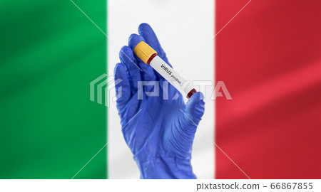 hand holding beaker with positive virus blood test 66867855