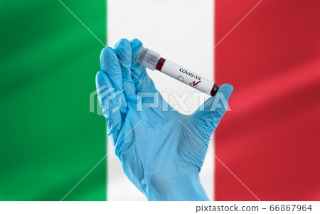 hand holding beaker with coronavirus blood test hand holding beaker with coronavirus blood test 66867964