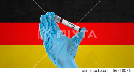 hand holding beaker with coronavirus blood test hand holding beaker with coronavirus blood test 66868086