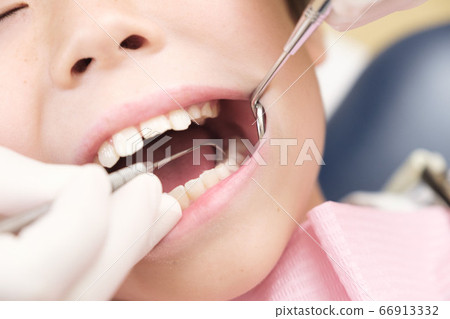 Children undergoing dental checkup: Search for tooth decay with a probe 66913332