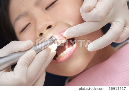 Child receiving tooth cleaning at the dentist 66913337