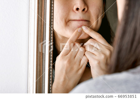 Acne pus, Close up photo of acne prone skin, Woman looking at mirror and hand squeezing her acne Acne pus, Close up photo of acne prone skin, Woman looking at mirror and hand squeezing her acne 66953851