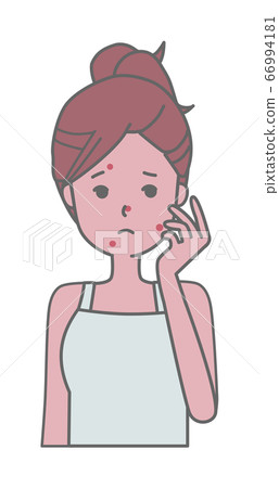 Illustration of woman suffering from acne on face - Stock Illustration ...