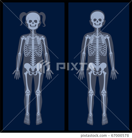 Skeleton x ray Skeleton x ray 67000578