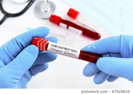Coronavirus blood test concept. Coronavirus blood test concept. 67020620