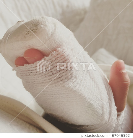 Hospitalization 67046592