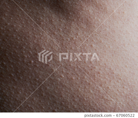 Pattern of human skin with bumps Pattern of human skin with bumps 67060522