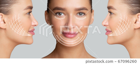 Beautiful woman with arrows on face for lifting skin 67096260