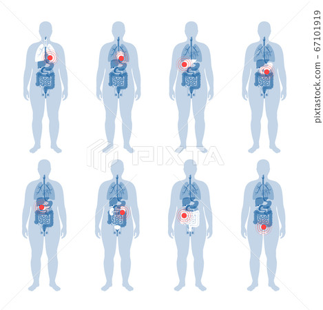 Pain in human body 67101919