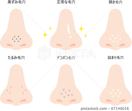 Nose pore set 67148016