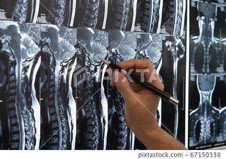 doctor spine x-ray doctor spine x-ray 67150338