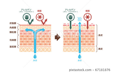 Cross-section illustration of healthy skin and... - Stock Illustration ...