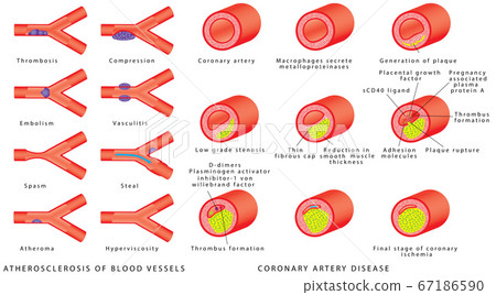 Blood vessels - arteries 67186590