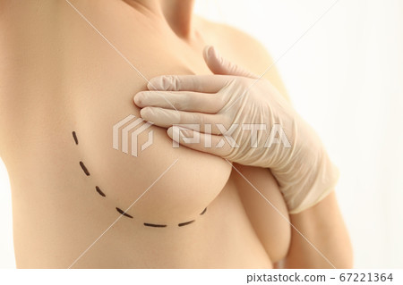 Cropped photo of lady ready for plastic correction 67221364
