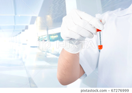 Doctor man in protective gloves holding a test 67276999