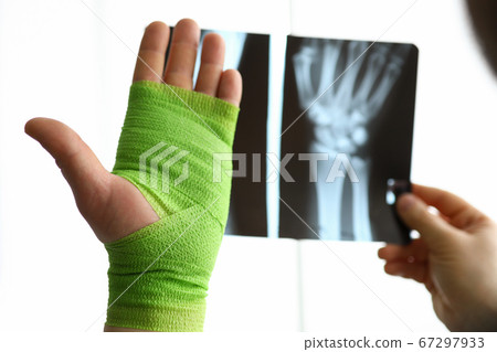 Close-up hand wrapped in bandage and x-ray hand 67297933
