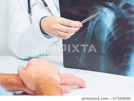 Female doctors hand pointing at x-ray medical Female doctors hand pointing at x-ray medical 67309690