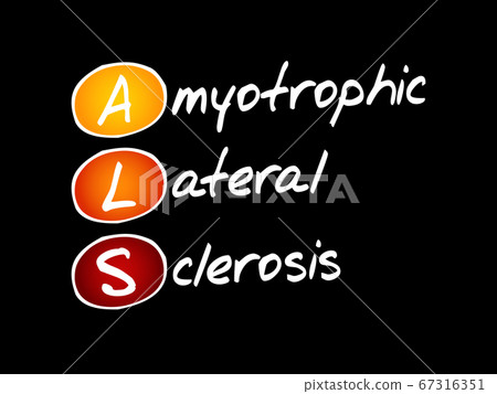 ALS - Amyotrophic Lateral Sclerosis ALS - Amyotrophic Lateral Sclerosis 67316351