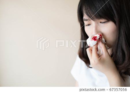Young Asian woman suffering from nose bleeding and using tissue paper for stop bleeding over white background. Cause of nosebleed include allergic rhinitis, respiratory infection or hypertension. Young Asian woman suffering from nose bleeding and using tissue paper for stop bleeding over white background. Cause of nosebleed include allergic rhinitis, respiratory infection or hypertension. 67357056