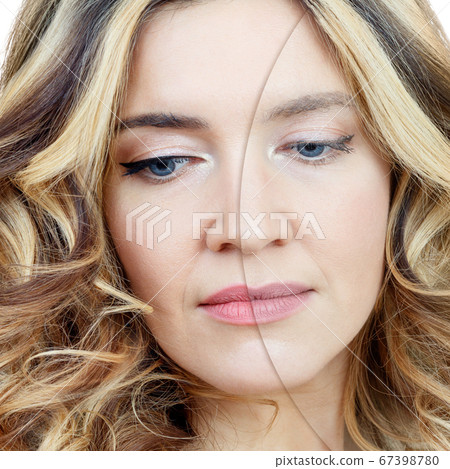 Woman with acne before and after treatment and makeup. Woman with acne before and after treatment and makeup. 67398780