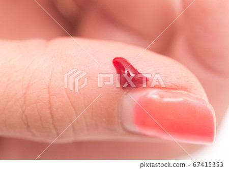blood on finger blood on finger 67415353